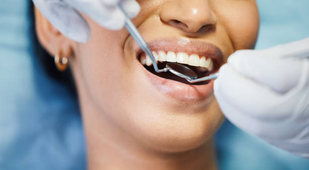 Best Emergency Broken Tooth Repair in Lutcher, LA