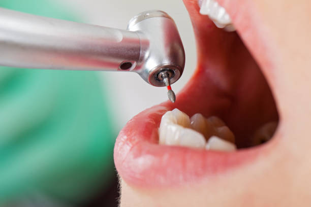 Best Weekend Emergency Dentist in Lutcher, LA